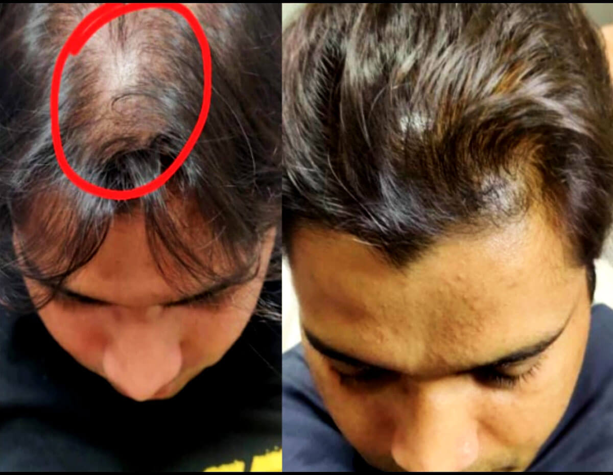 Hair Fall Control ayurvedic hair oil